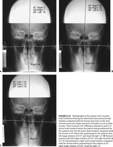 how long is the validity of x ray result in the philippines